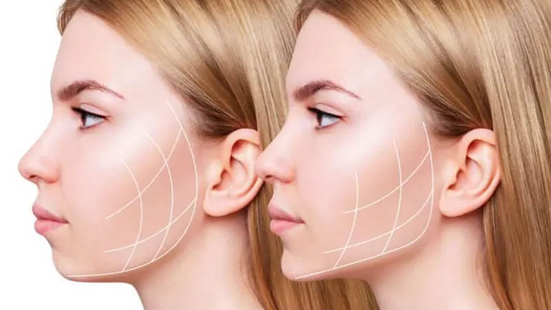 بوکال فت کلینیک زیبایی دلوان