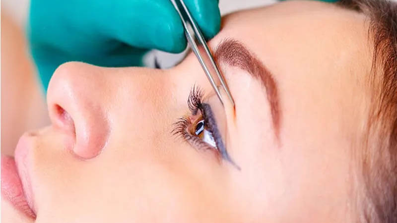 مزوتراپی در کلینیک زیبایی دلوان