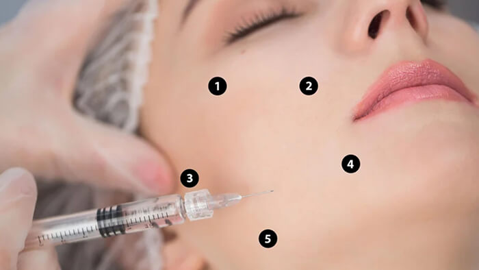 هزینه مزوژل در مقابل مزوتراپی